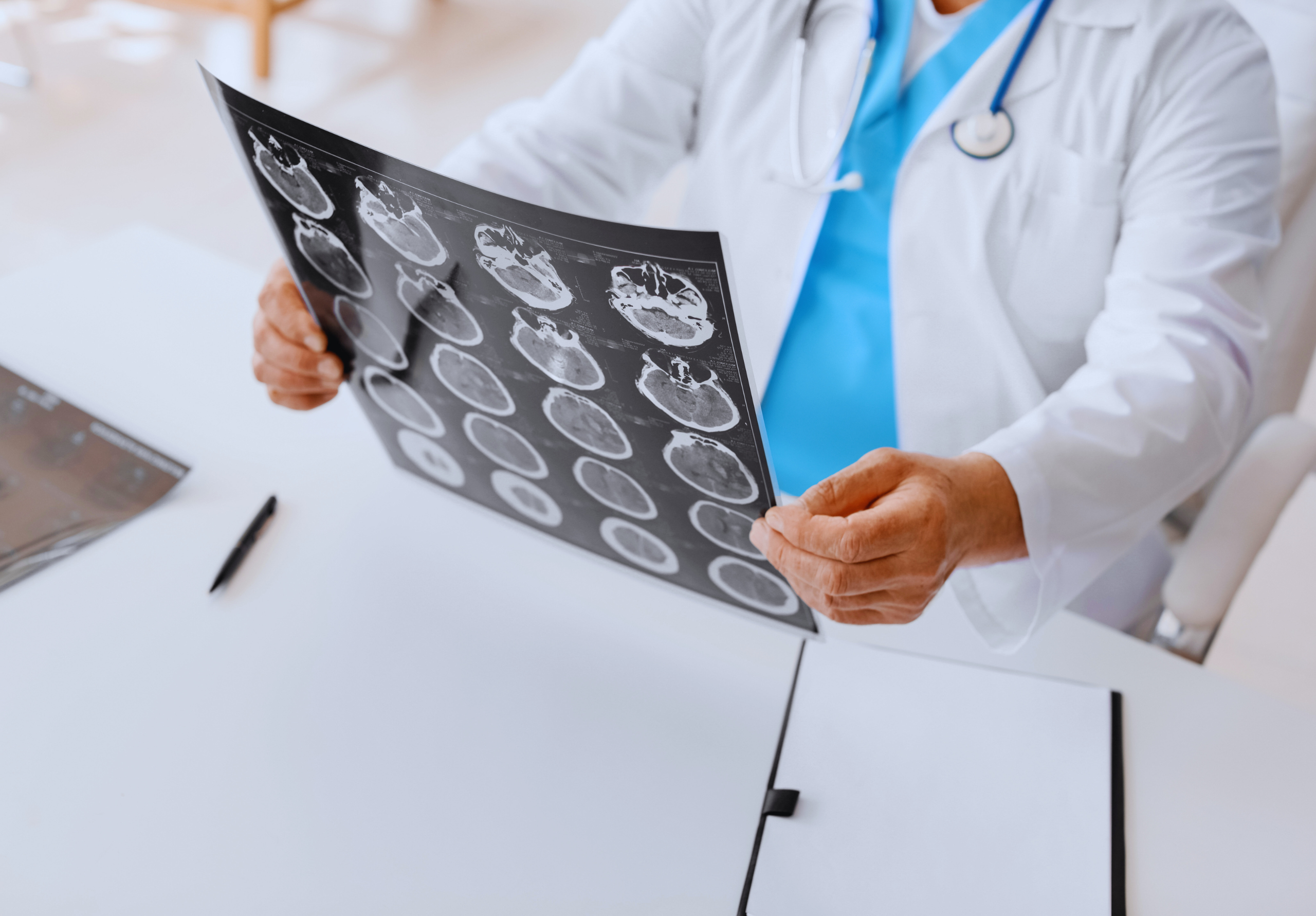 What is the traumatic brain injury - Anrea's Angels' Blog - 1